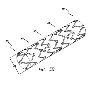 Flexible Intravascular Stent Devices from Abbott