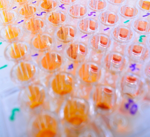 ELISA for diagnosis of Crohn's disease: Serological detection of IL-23 Receptor variants